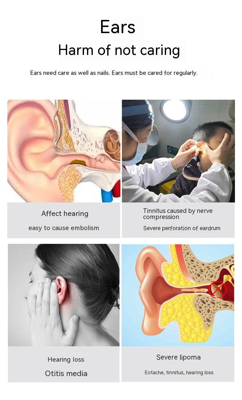 Wireless Smart HD Endoscope Ear Pick